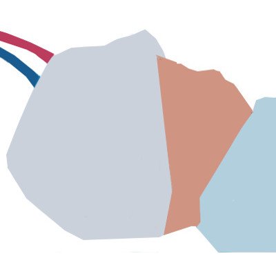 bébé mis sous hypothermie pour une anoxo-ischémie